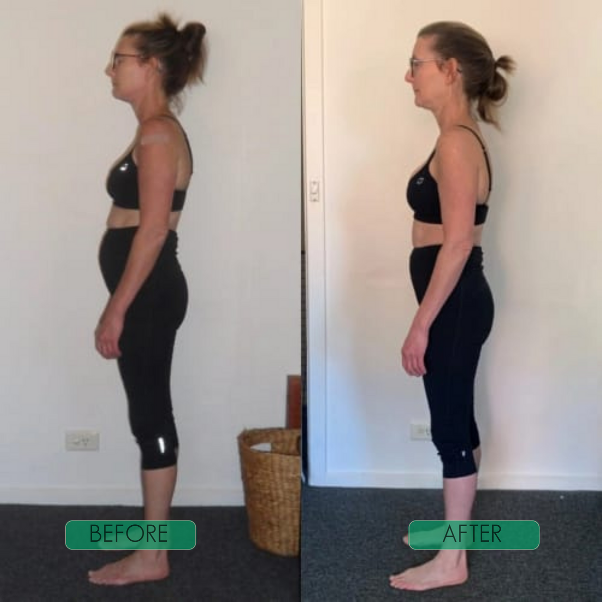 Alignwell™ Instant Posture Corrector Straps