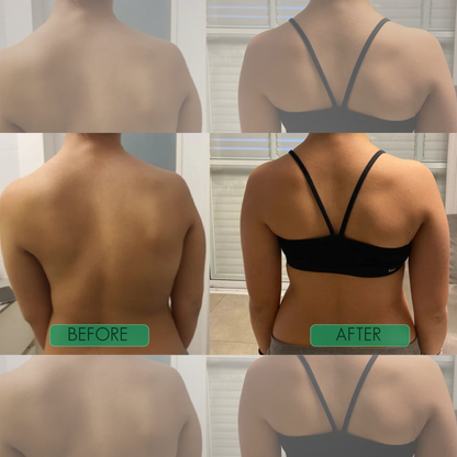 Alignwell™ Instant Posture Corrector Straps